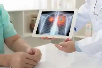 Cardiothoracic Surgery (CVTS)